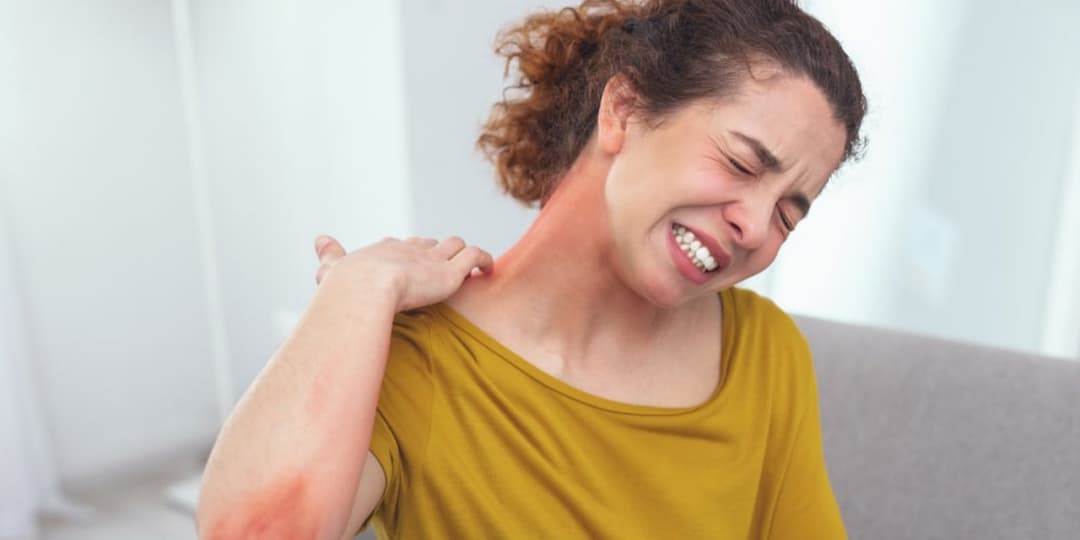 Tratamiento de Anafilaxia